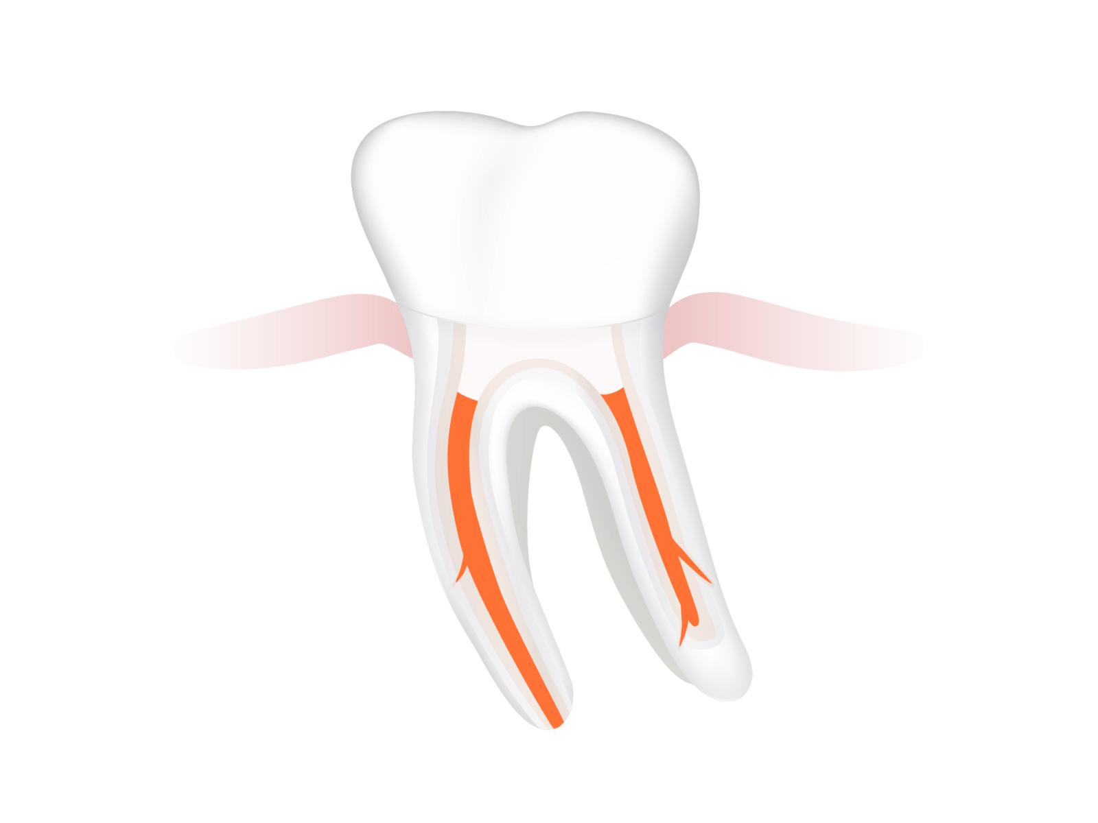 Abbildung mit Krone bzw. Teilkrone